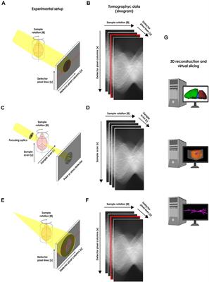 Illuminating the Brain With X-Rays: Contributions and Future Perspectives of High-Resolution Microtomography to Neuroscience